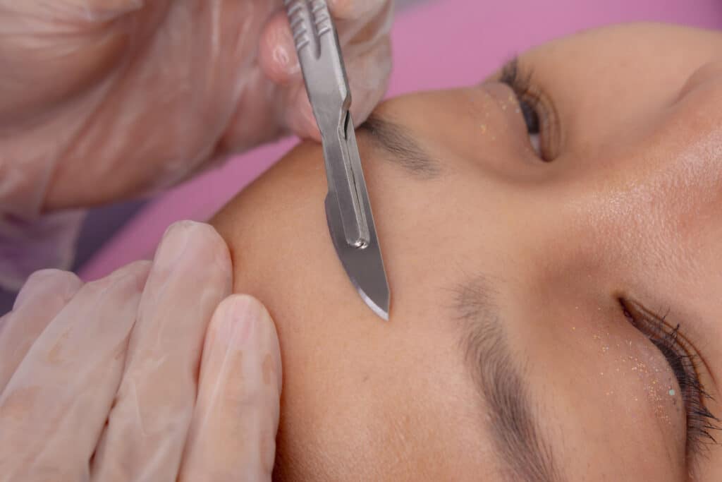 Close-up of dermaplaning or microplaning procedure to closely shave and exfoliating the skin. Dermaplaning in Henderson, NV